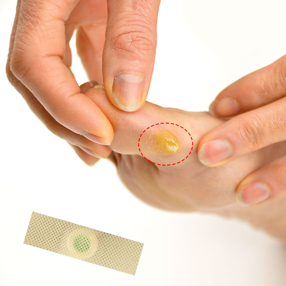 60Pcs 풋 케어 의료용 패치 세트 옥수수 및 굳은살 - Detox Foot Patch 리뷰 및 가격
